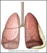 Lung